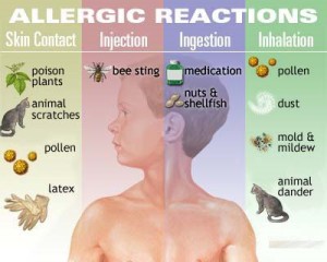common causes of allergic reactions